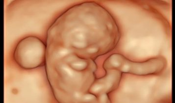 ultrasound packages in Perth